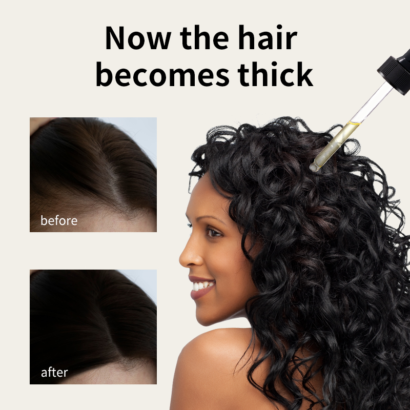 น้ำมันเจริญเติบโตของเส้นผม Syulli | น้ำมันป้องกันผมร่วงโรสแมรี่และขิง | กระตุ้นรูขุมขน