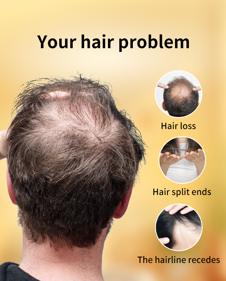 防脱生发油(黄色)-第二版_02