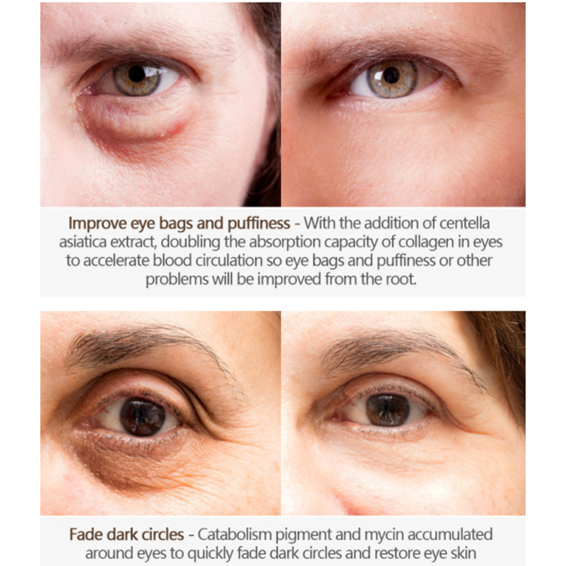 ครีมบำรุงรอบดวงตาต่อต้านริ้วรอยแบบกำหนดเองด้วย Applicator (2) 